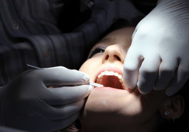 El problema del exceso de sarro dental