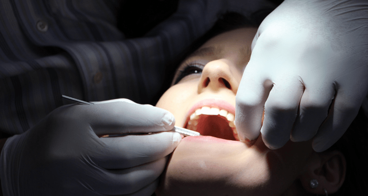 El problema del exceso de sarro dental