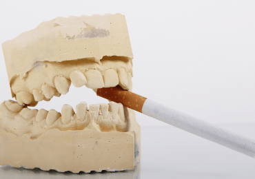 ¿Cómo afecta el tabaco a nuestros dientes?
